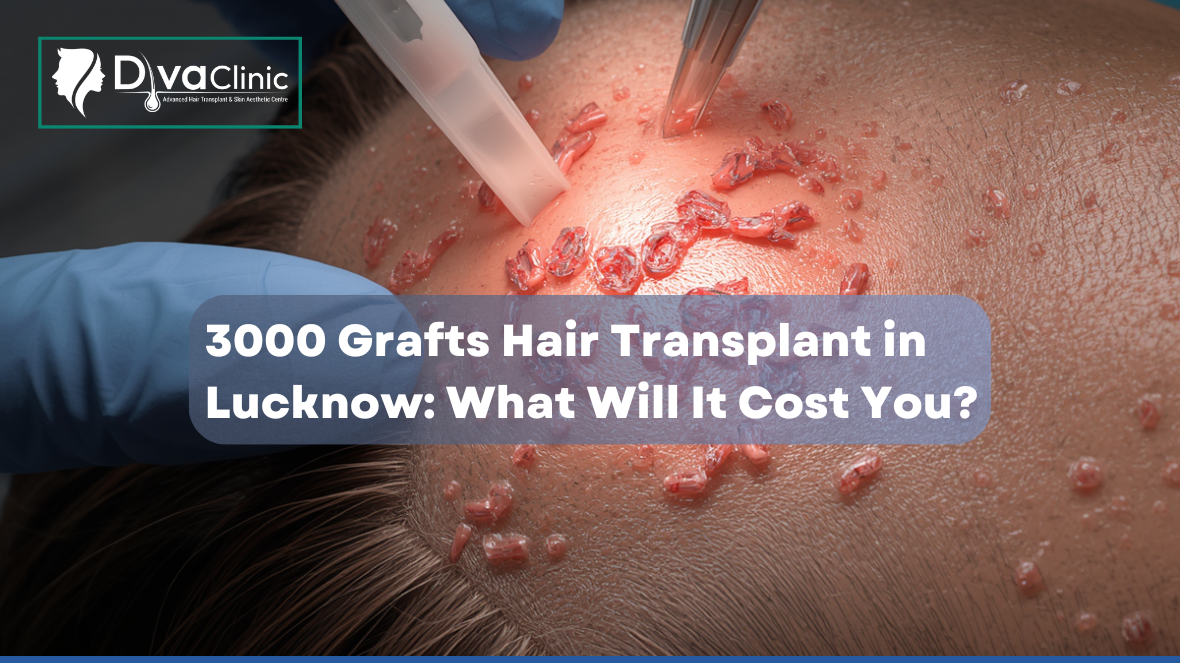 How much will a 3000 graft hair transplant cost in Lucknow?