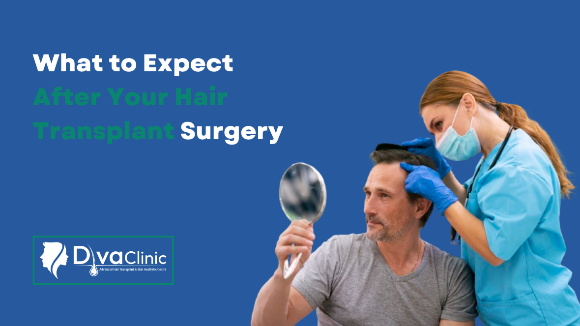 What to Expect After Your Hair Transplant Surgery