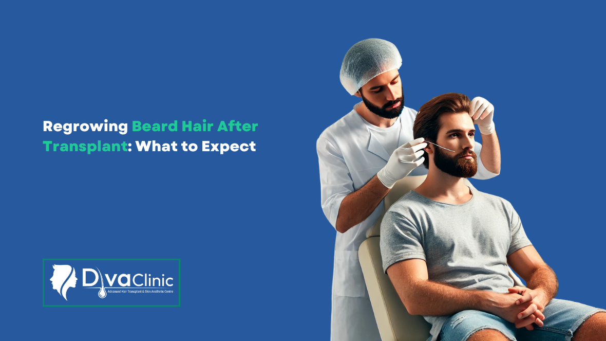 Can You Regrow Beard Hair After a Transplant? What to Expect