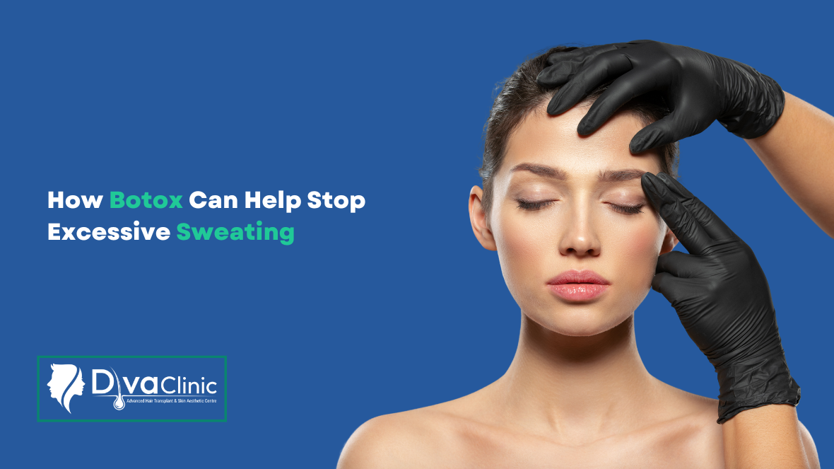 How Botox Can Help You Stop Excessive Sweating