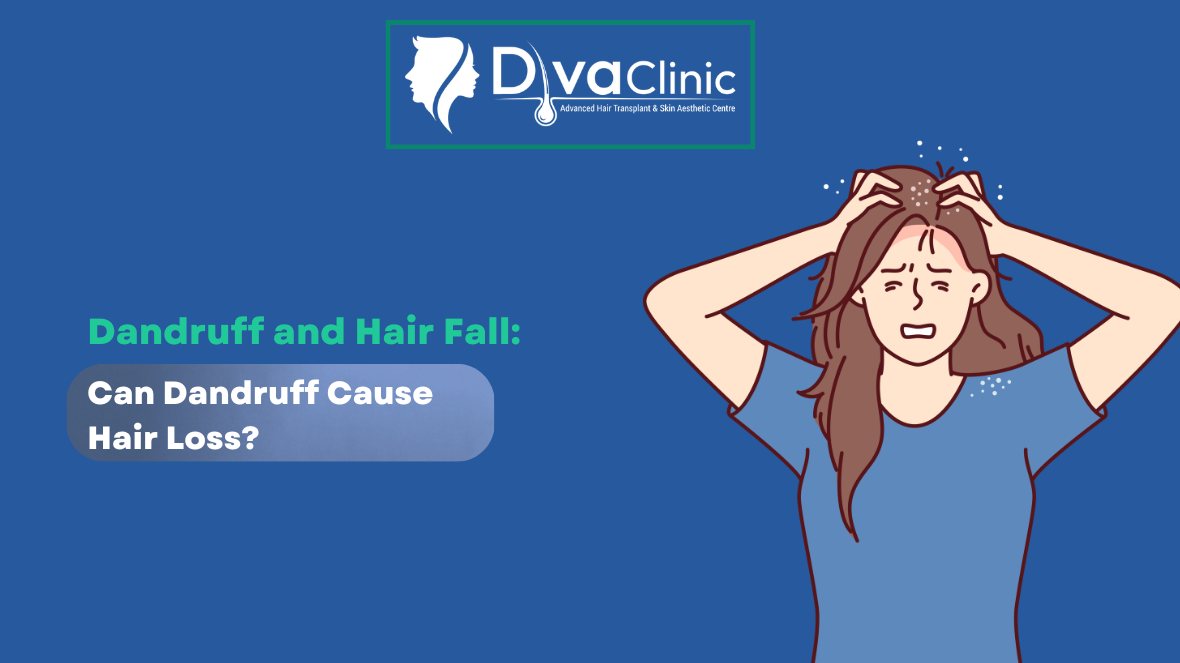 Dandruff and Hair Fall
