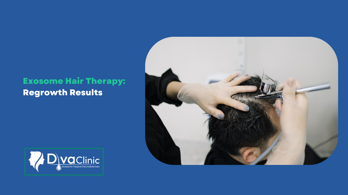 How Exosome Hair Therapy is Transforming Hair Regrowth: Before and After Results