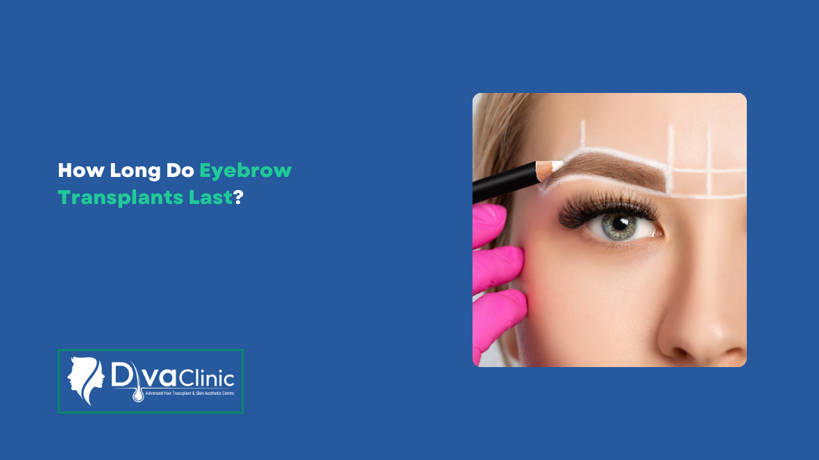 How Long Do Eyebrow Transplants Last?