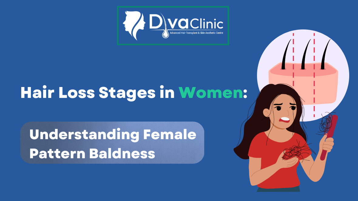 Stages of hair loss in women with visible scalp thinning