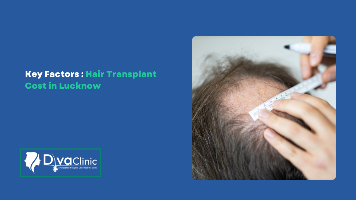 Cost of Hair Transplants in Lucknow: What Factors Influence the Price?