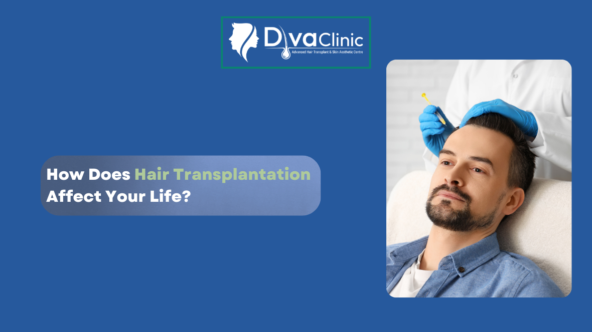 How Does Hair Transplantation Affect Your Life?