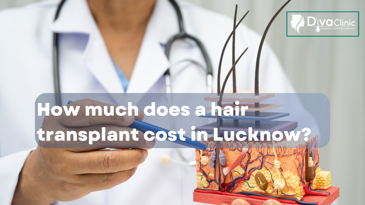 How much does a hair transplant cost in Lucknow?