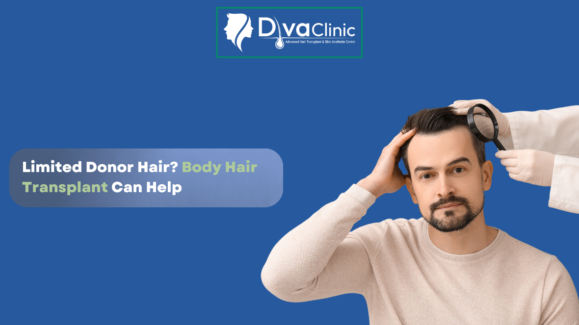 Body Hair to Scalp Transplant: A Practical Solution for Limited Donor Hair