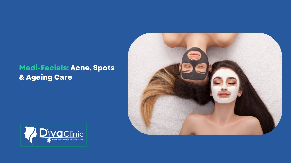Medi-Facials for Acne, Pigmentation, and Anti-Ageing: Before and After