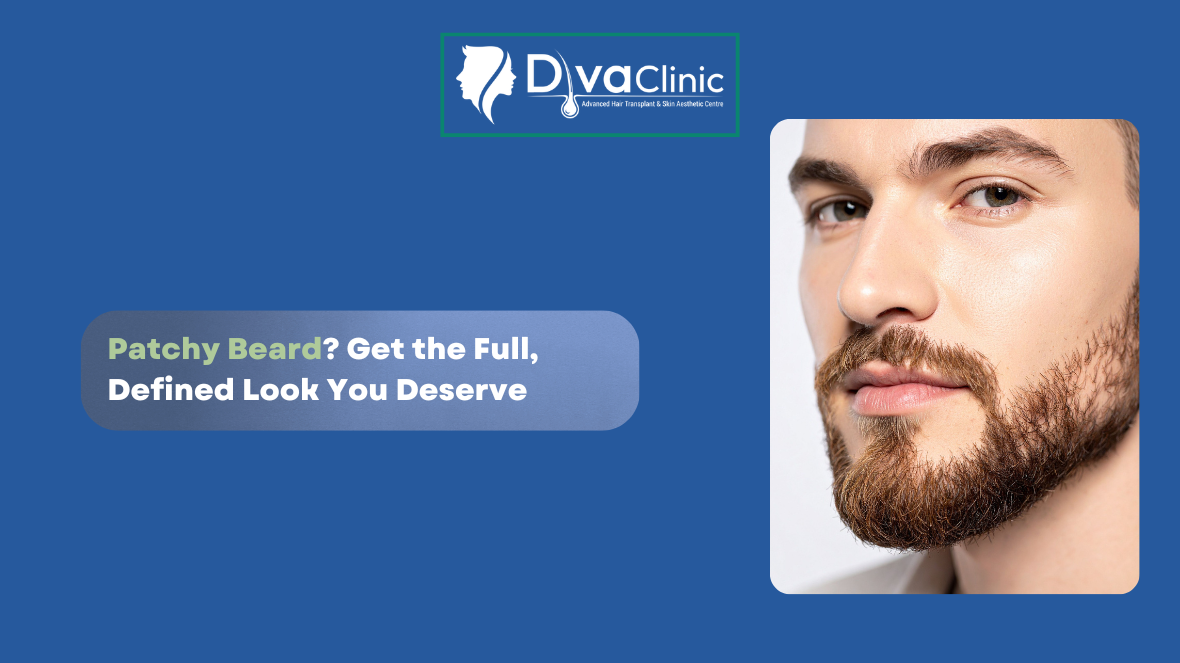 Beard Reconstruction by Hair Transplant: A Permanent Solution for Patchy or Thin Beard