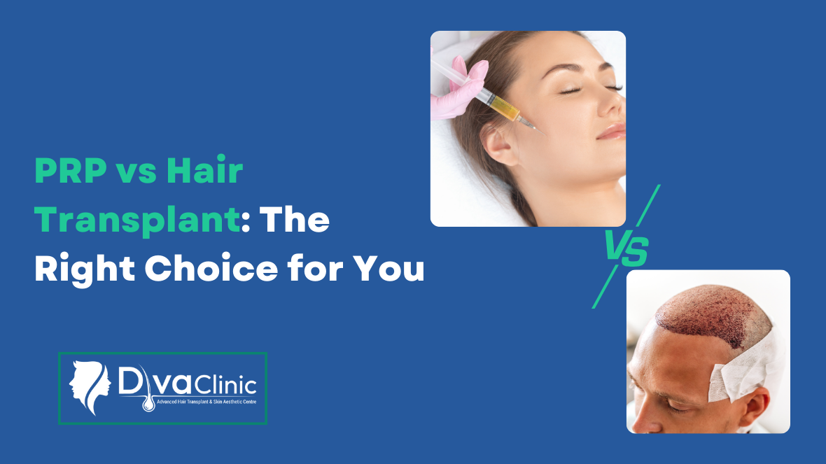 PRP vs Hair Transplant: Which Option Is Right for You?