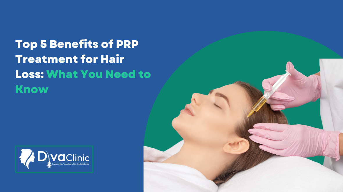 Top 5 Benefits of PRP Treatment for Hair Loss: What You Need to Know