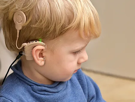 Cochlear Implants