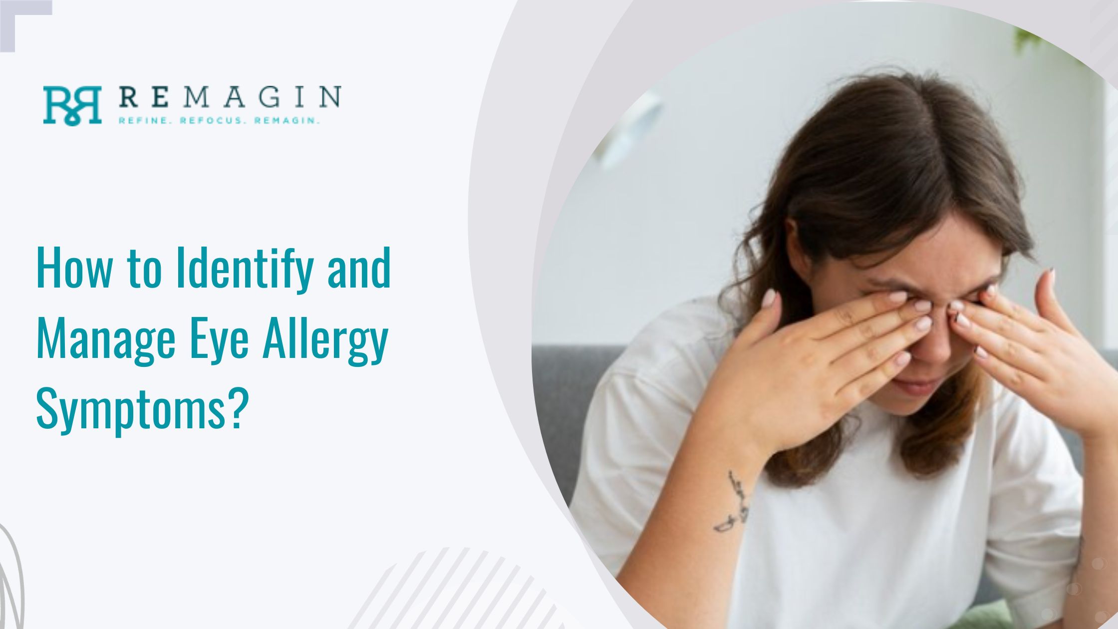 How to Identify and Manage Eye Allergy Symptoms?
