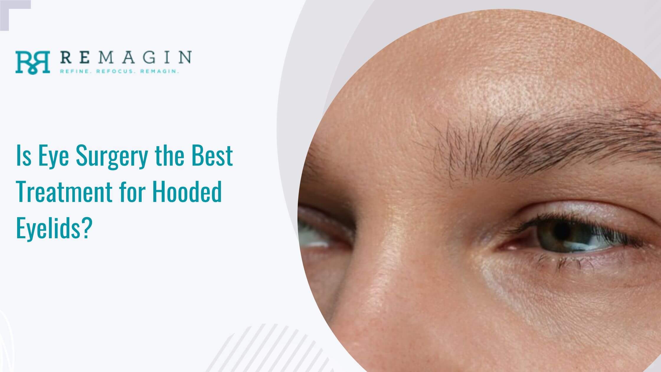 best treatment for hooded eyelids