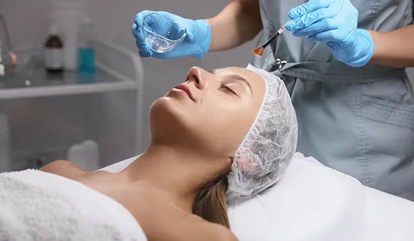 What to Expect After the Chemical Peel?