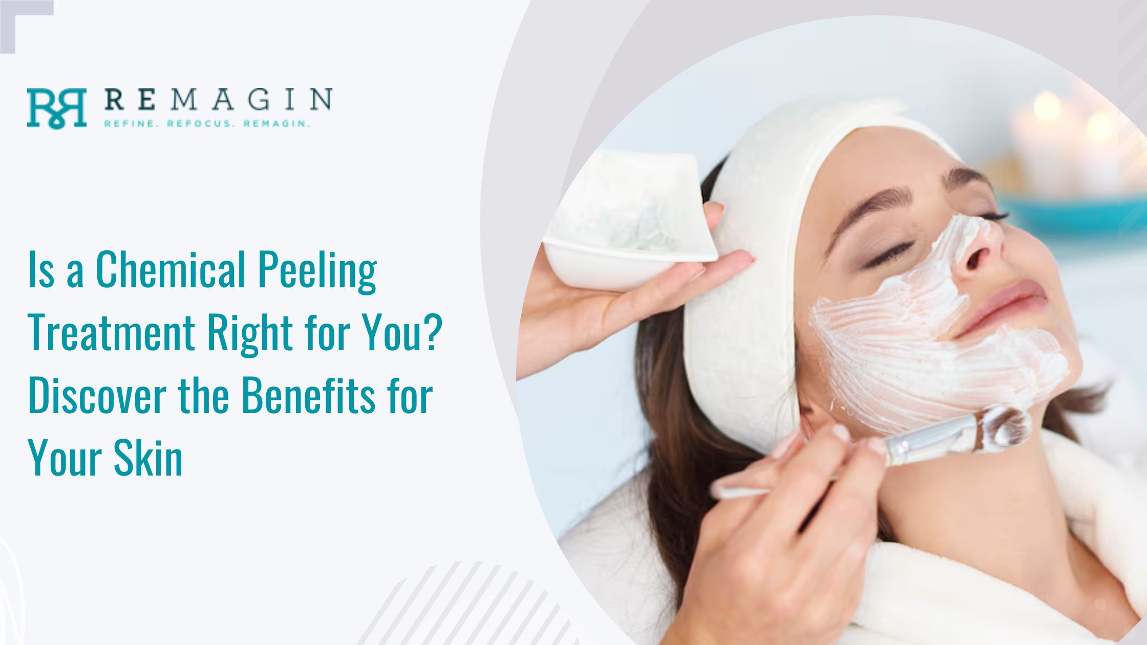 Is a Chemical Peeling Treatment Right for You? Discover the Benefits for Your Skin