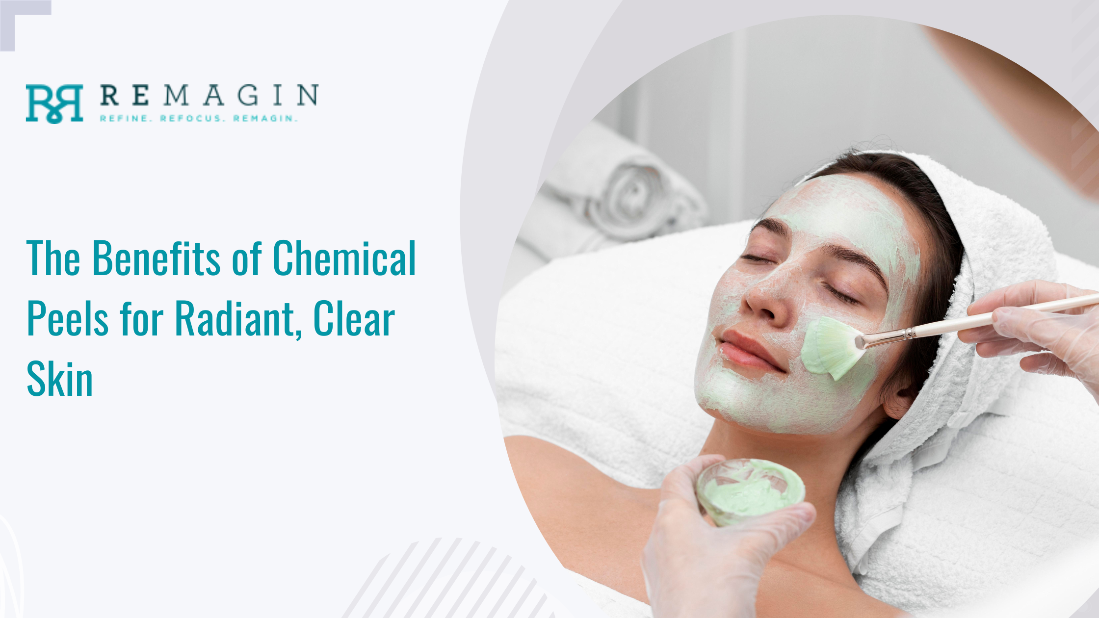 Chemical peels benefit