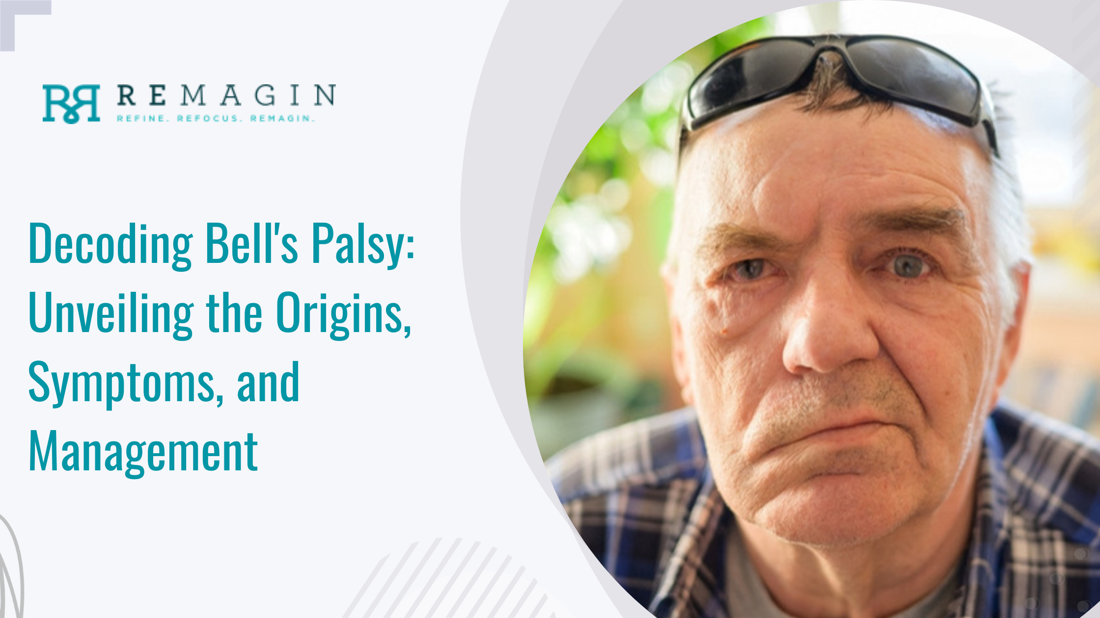 Decoding Bell's Palsy: Unveiling the Origins, Symptoms, and Management 