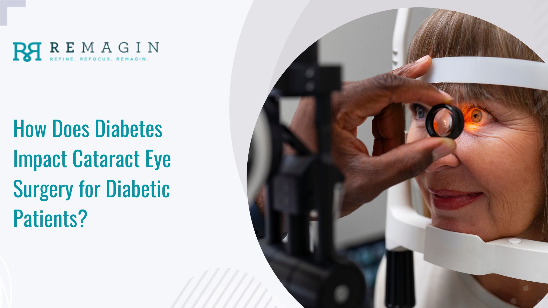 How Does Diabetes Impact Cataract Eye Surgery for Diabetic Patients?