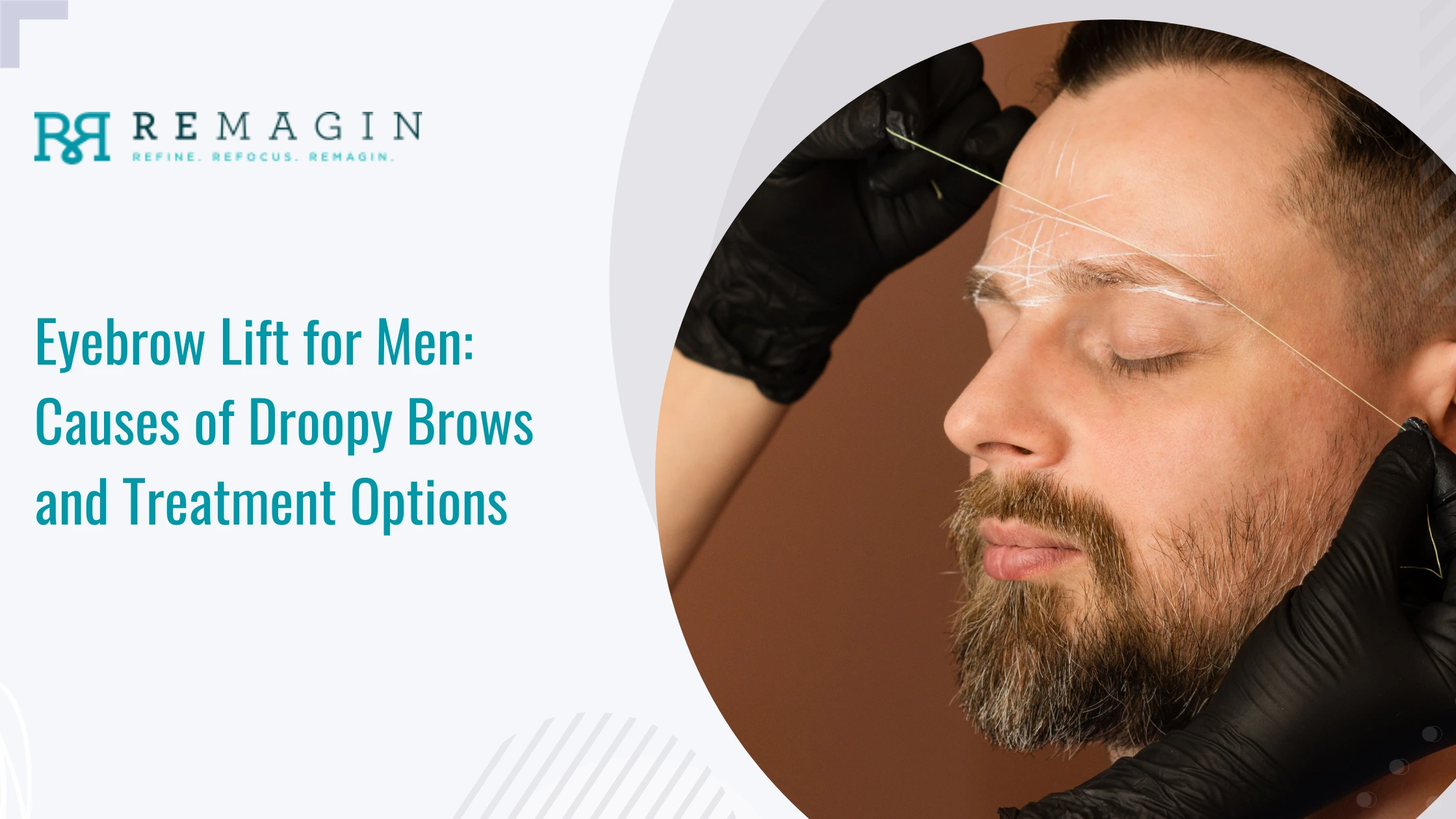 Eyebrow Lift for Men: Causes of Droopy Brows and Treatment Options