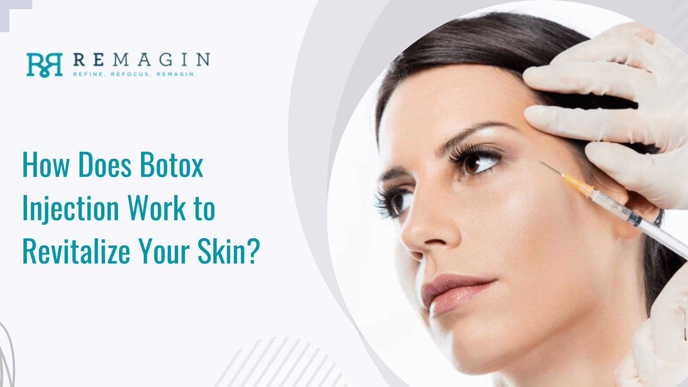 How Does Botox Injection Work to Revitalize Your Skin?