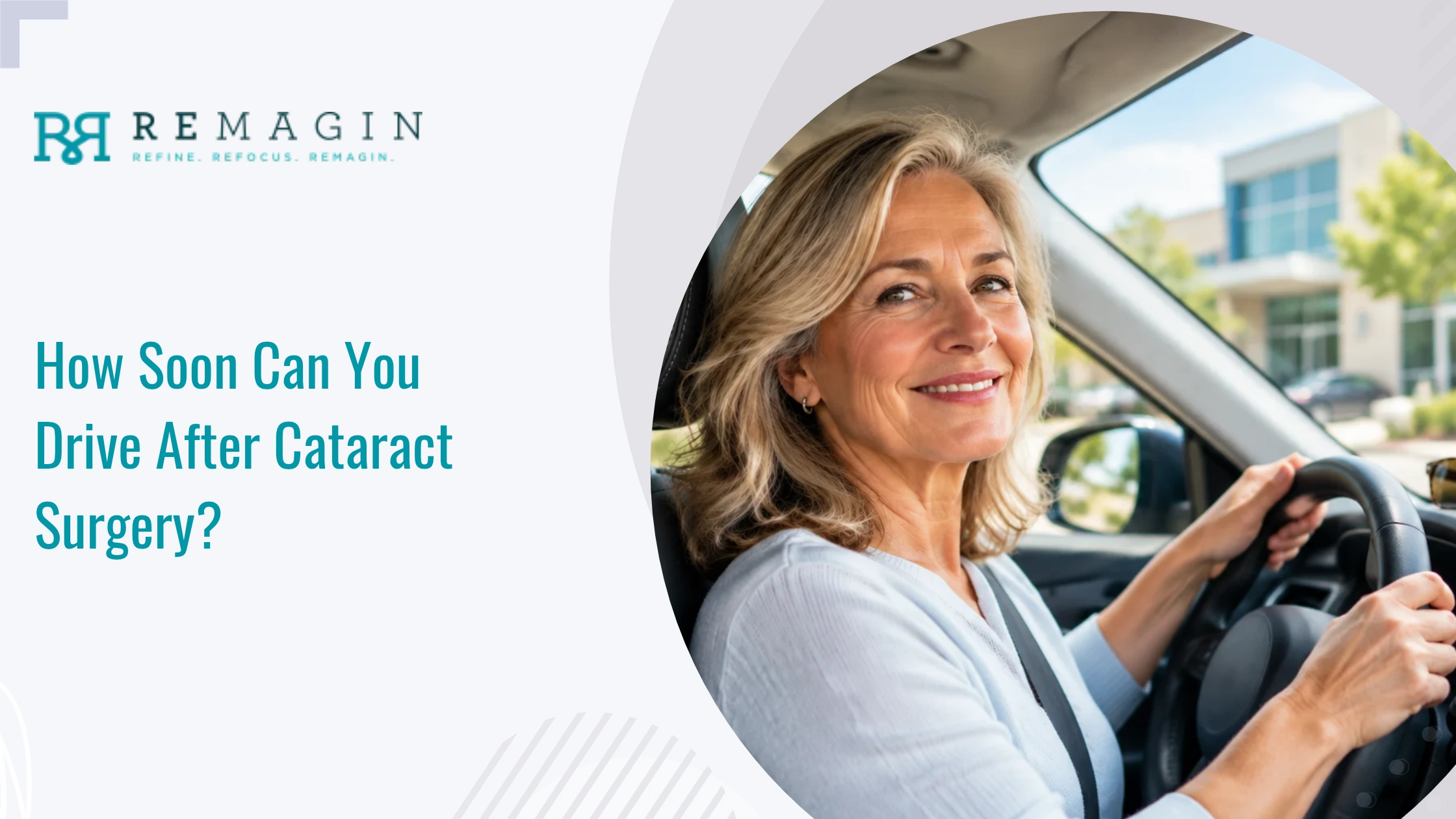 How Soon Can You Drive After Cataract Surgery?
