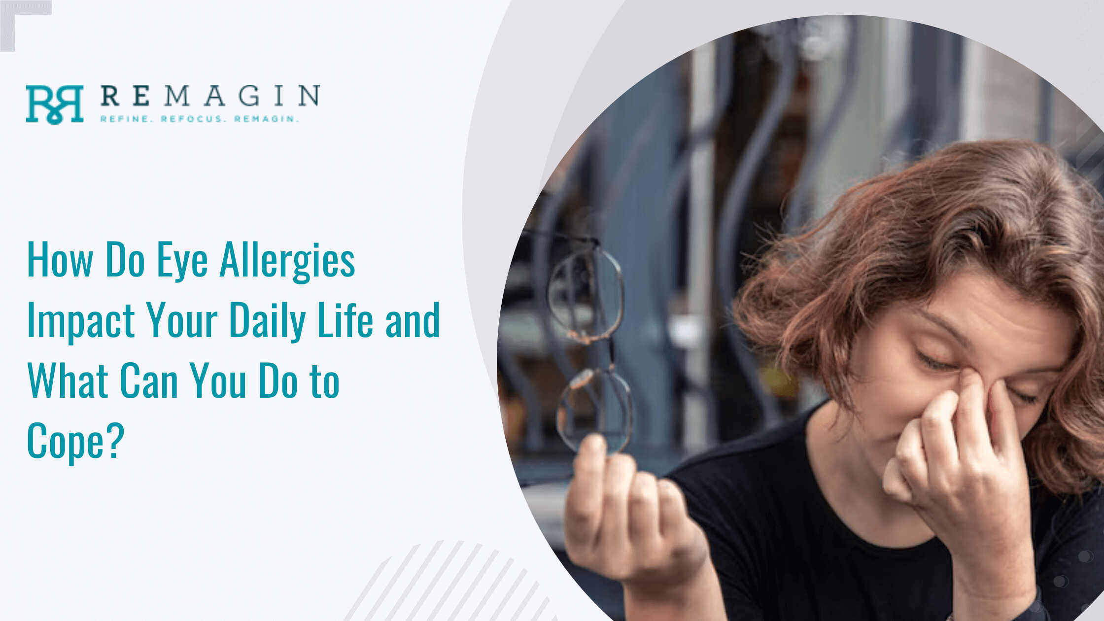 How Do Eye Allergies Impact Your Daily Life and What Can You Do to Cope?
