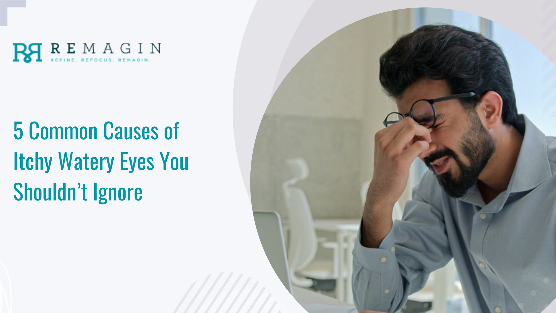 5 Common Causes of Itchy Watery Eyes You Shouldn’t Ignore