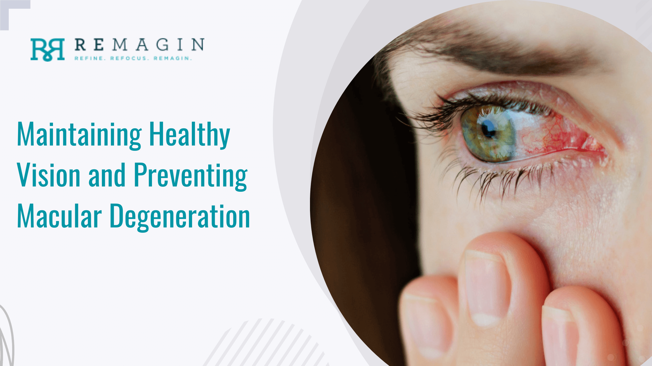 Maintaining Healthy Vision and Preventing Macular Degeneration