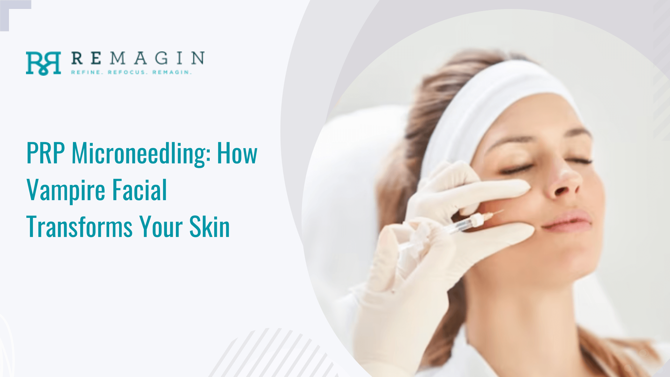 PRP Microneedling: How Vampire Facial Transforms Your Skin