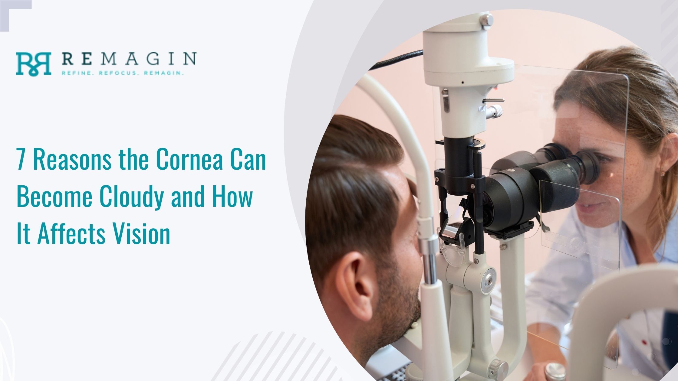 7 Reasons the Cornea Can Become Cloudy and How It Affects Vision