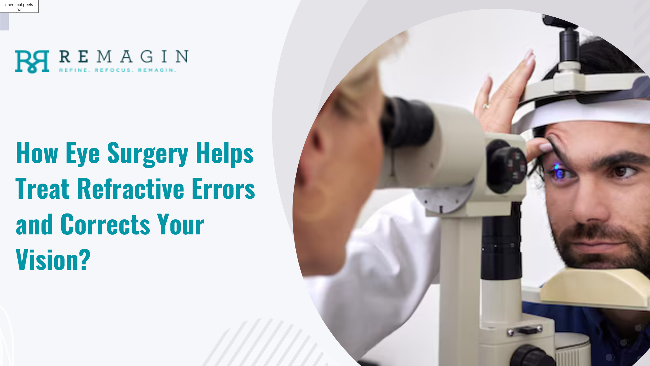 How Eye Surgery Helps Treat Refractive Errors and Corrects Your Vision?