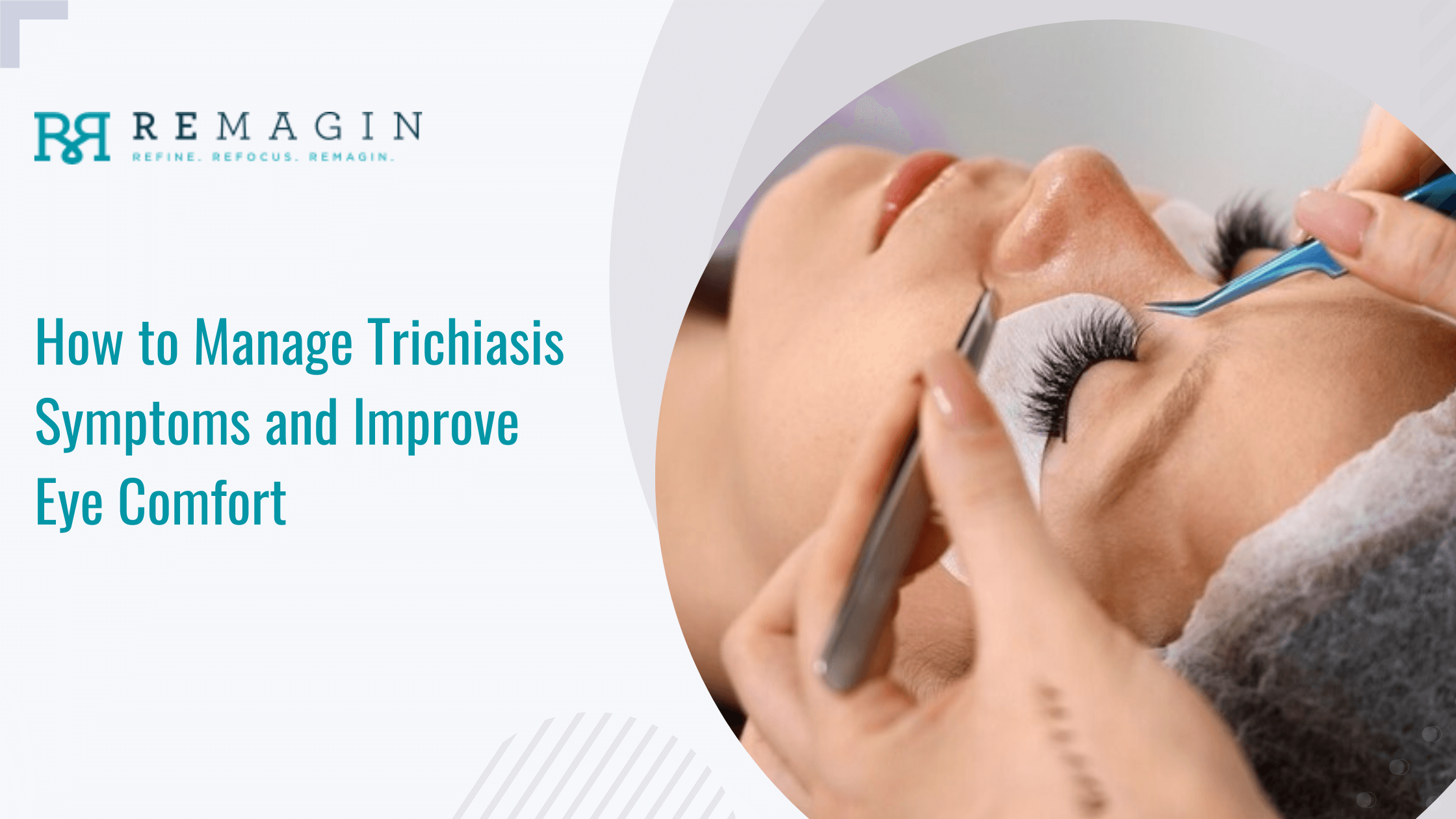 How to Manage Trichiasis Symptoms and Improve Eye Comfort