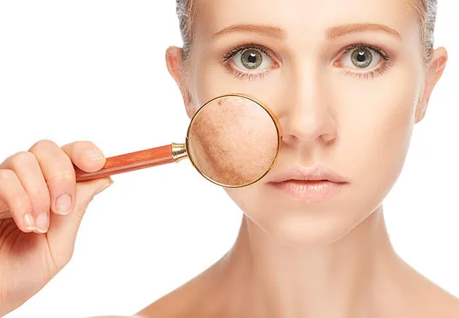 What to Expect After Skin Pigmentation Treatment?