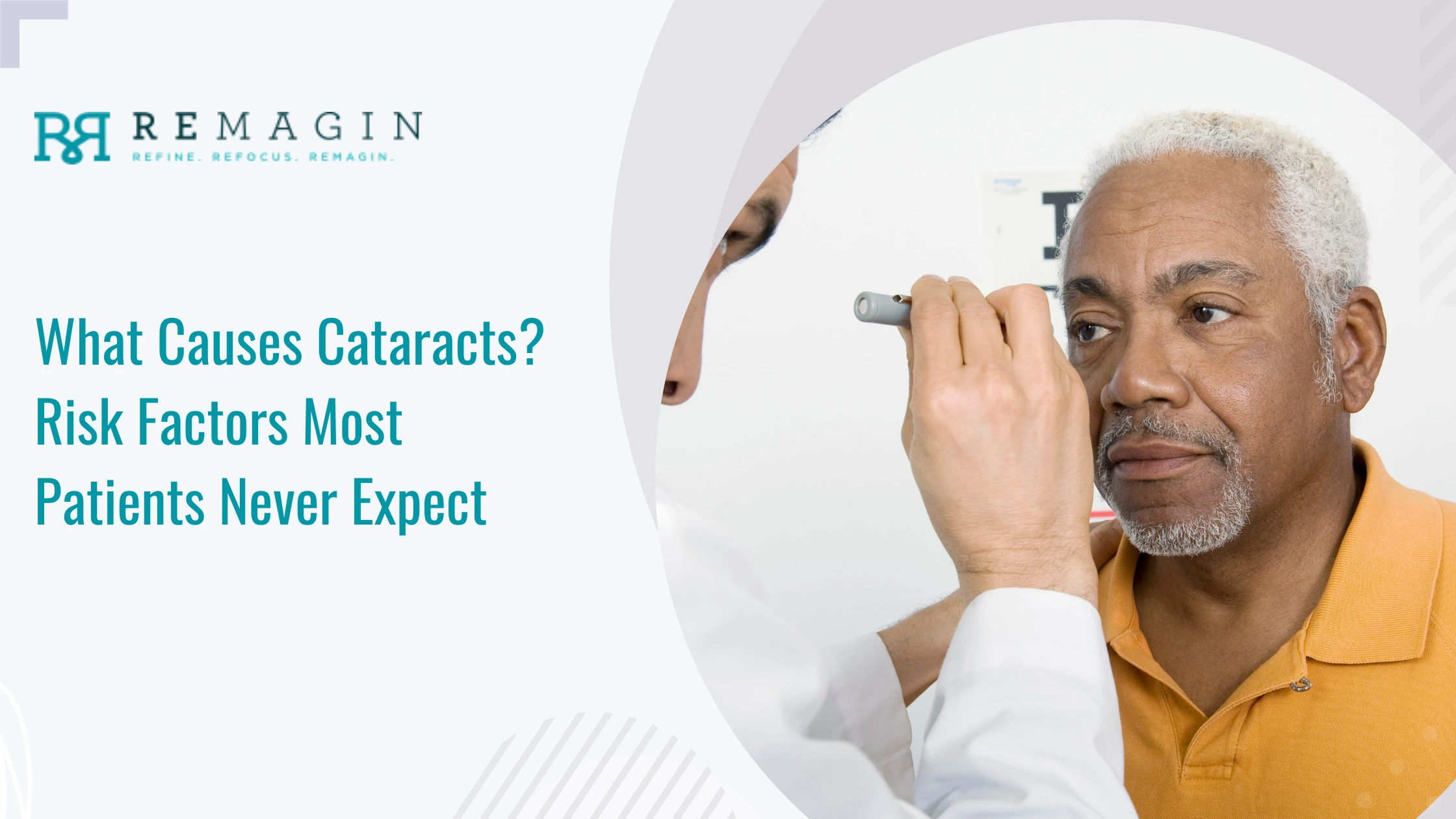What Causes Cataracts? Risk Factors Most Patients Never Expect