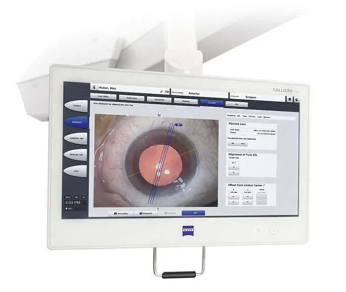 Why Choose Remagin for Cataract Surgery?