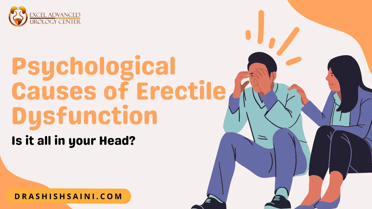 Psychological Causes of Erectile Dysfunction: Is it all in your Head?
