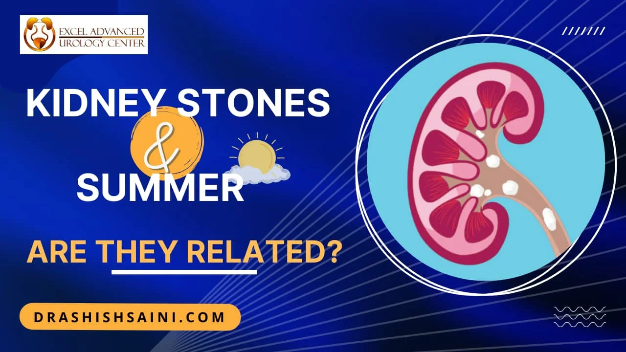 Kidney Stones and Summer - Are they related?
