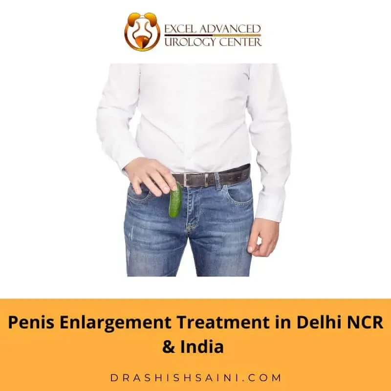 Penis Enlargement Treatment in delhi