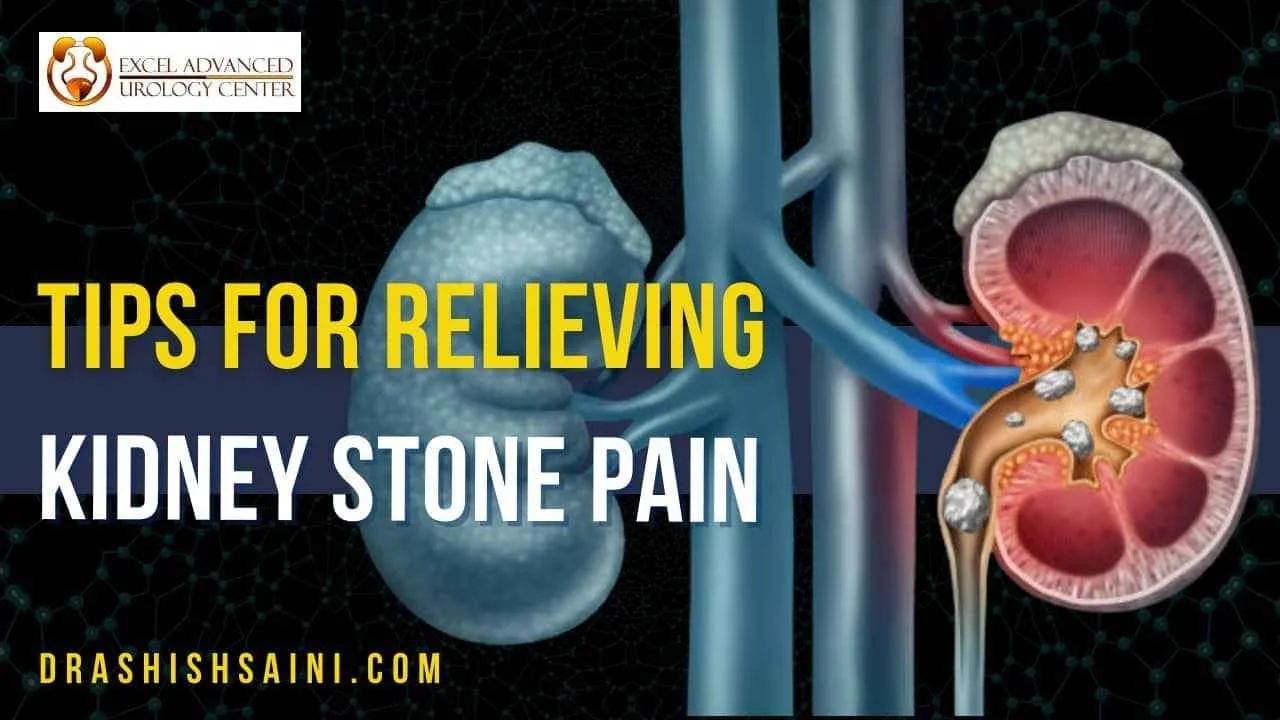 TIPS FOR RELIEVING KIDNEY STONES PAIN