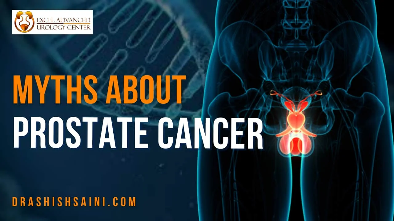 Myths About Prostate Cancer