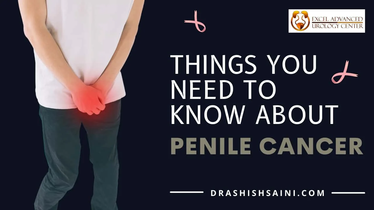 THINGS YOU NEED TO KNOW ABOUT PENILE CANCER 
