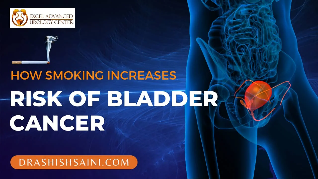 How Smoking Increases the Risk of Bladder Cancer - 2022 Tips