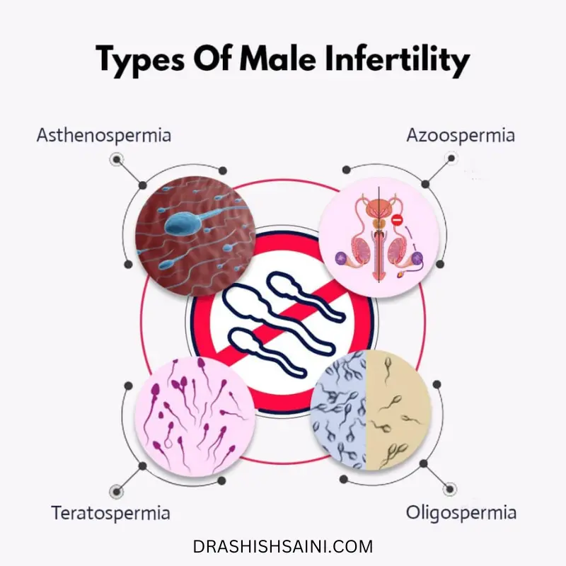 male infertility causes
- male fertility test
