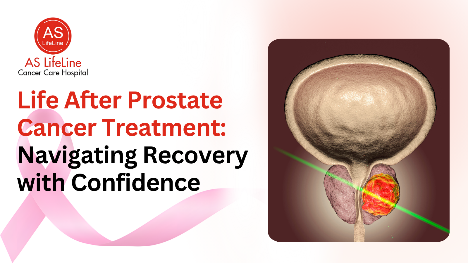 Life After Prostate Cancer Treatment: Navigating Recovery with Confidence
