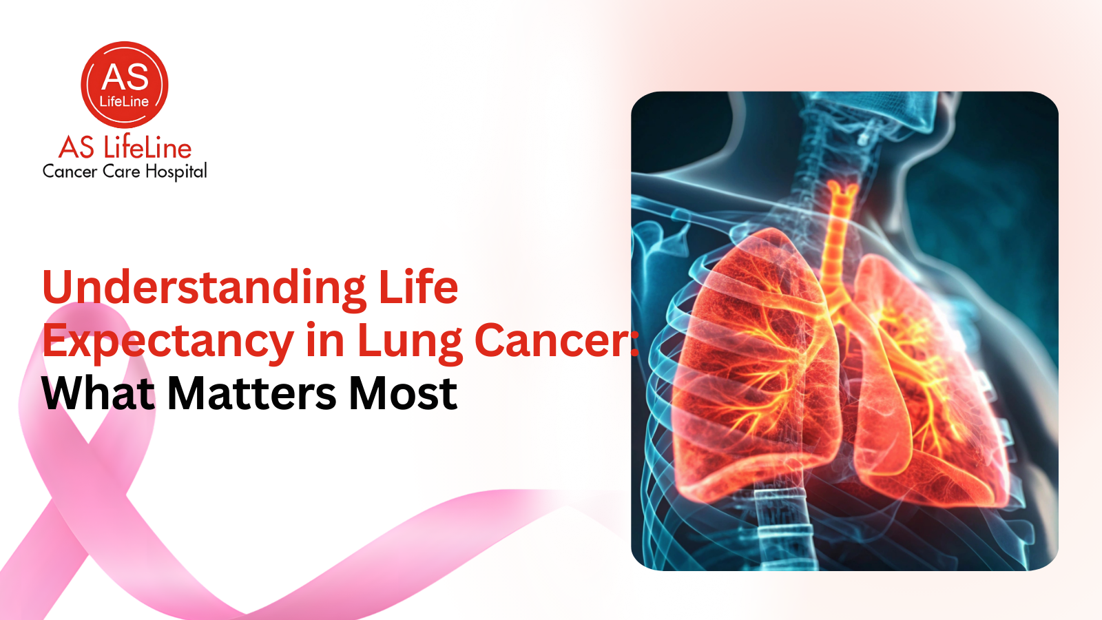 Lung Cancer