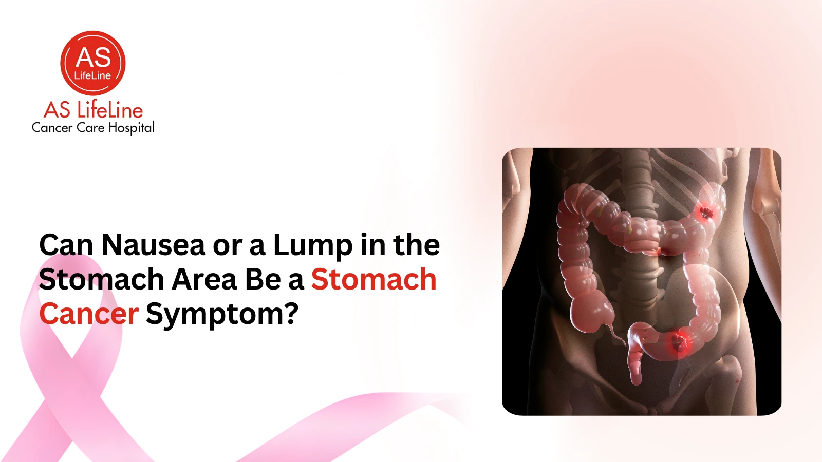 Can Nausea or a Lump in the Stomach Area Be a Stomach Cancer Symptom?