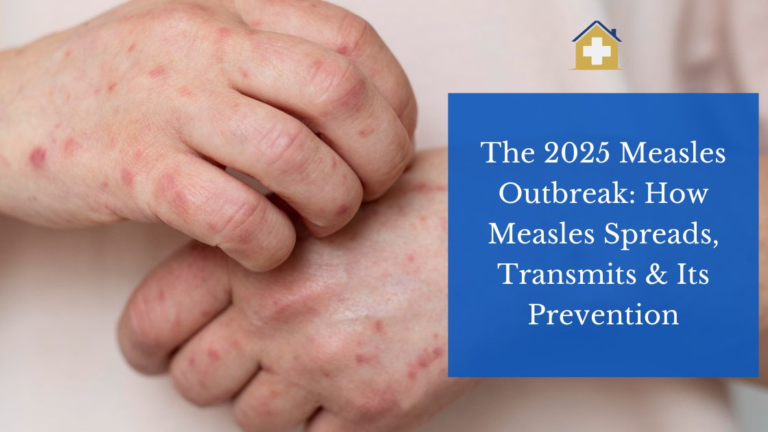 The 2025 Measles Outbreak: How Measles Spreads, Transmits & Its Prevention