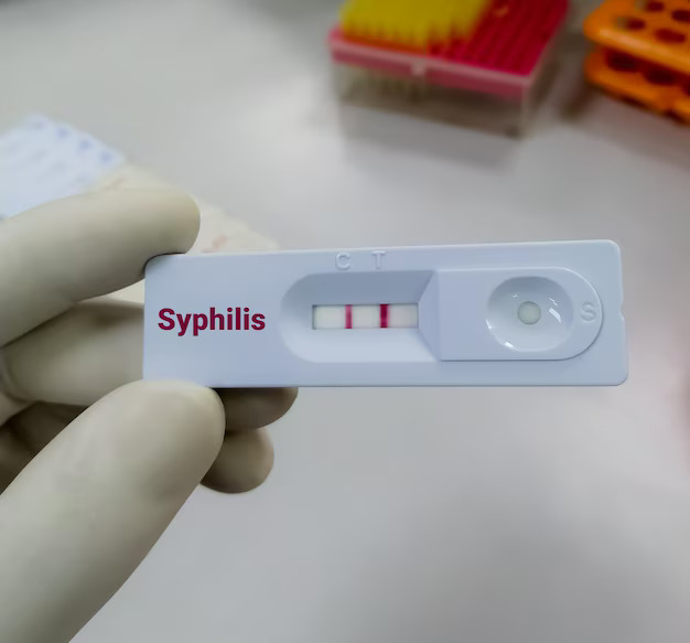 Positive Syphilis Test Result